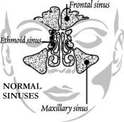 Normal sinuses